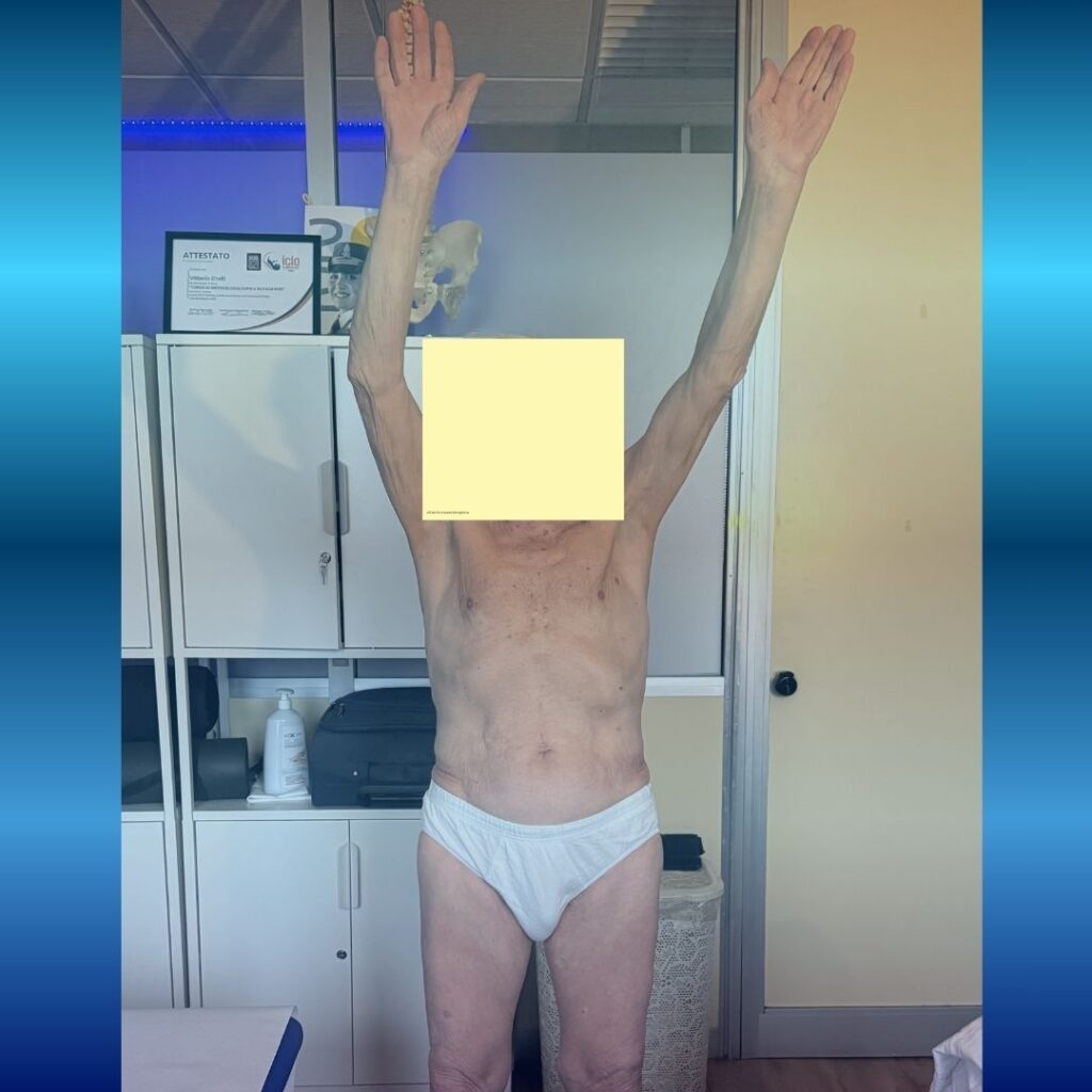 Trattamento geriatrico
