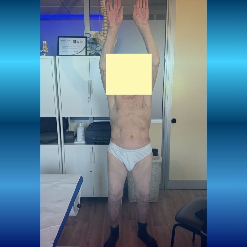 Trattamento geriatrico
